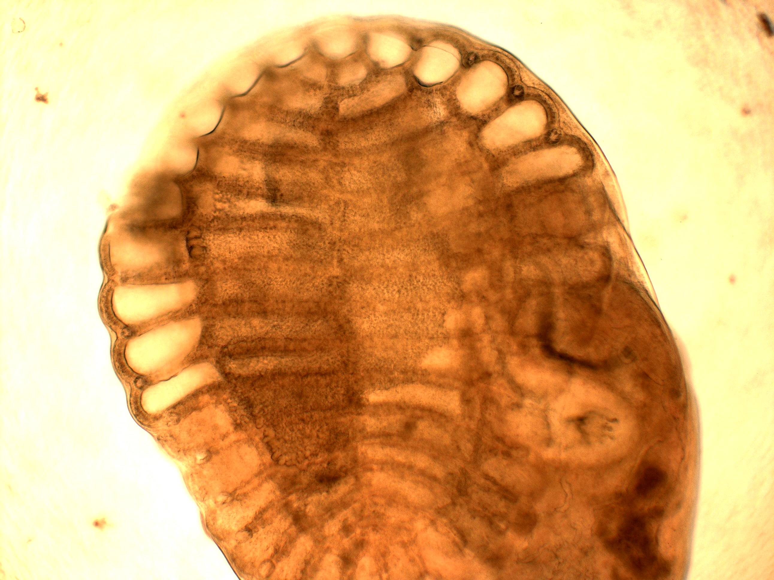 Паразит Aspidogaster conchicola — прохідне світло