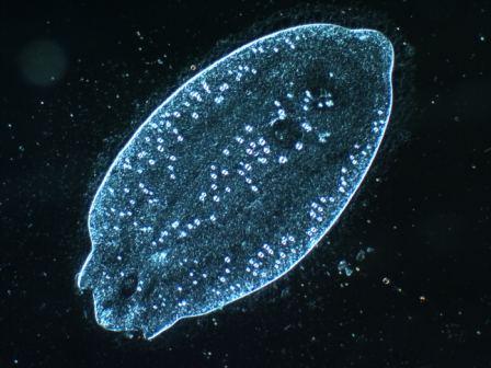 Diplostomum sp.
